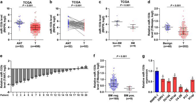 Transcriptional downregulation of mir-133b by rest promotes prostate cancer metastasis to bone via activating tgf-β signaling