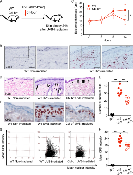 Cbl-b deficiency provides protection against uvb-induced skin damage by modulating inflammatory gene signature