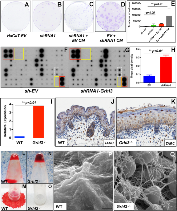 Loss Of Grhl3 Leads To Tarc Ccl17 Mediated Keratinocyte Proliferation In The Epidermis Cell Death Disease