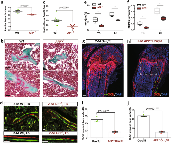 APP promotes osteoblast survival and bone formation by regulating ...