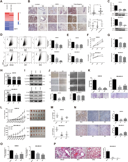 NMT1 inhibition modulates breast cancer progression through  stress-triggered JNK pathway