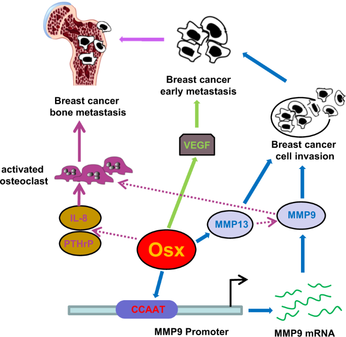 Upregulated Osterix Promotes Invasion And Bone Metastasis And Predicts For A Poor Prognosis In Breast Cancer Cell Death Disease
