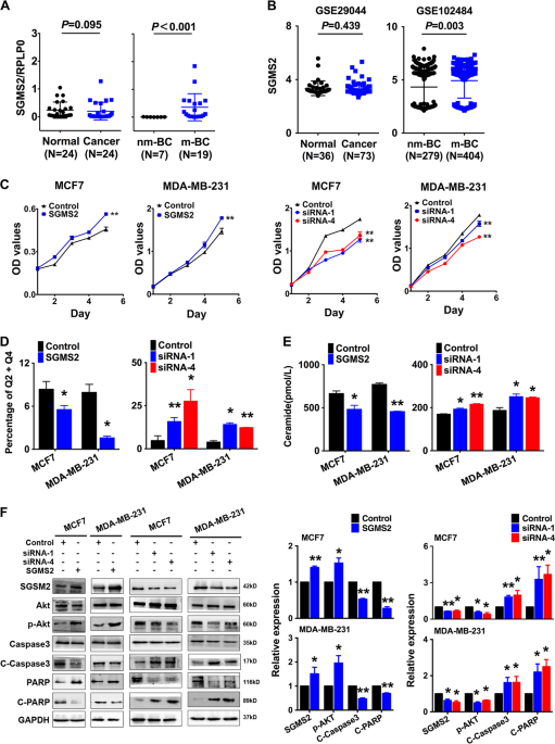 Sphingomyelin synthase 2 promotes an aggressive breast cancer phenotype by disrupting the homoeostasis of ceramide and sphingomyelin