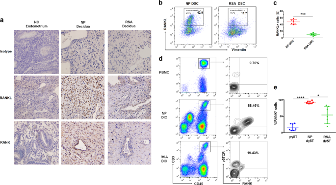 Decidual RANKL/RANK interaction promotes the residence and polarization of  TGF-β1-producing regulatory γδ T cells | Cell Death & Disease