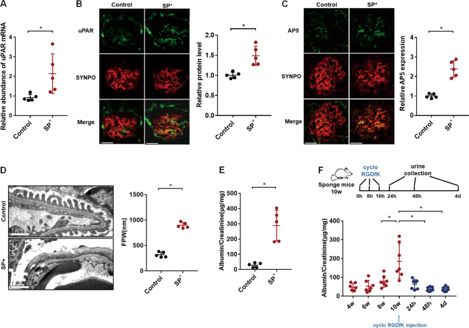 Mir 30 Family Prevents Upar Itgb3 Signaling Activation Through Calcineurin Nfatc Pathway To Protect Podocytes Cell Death Disease