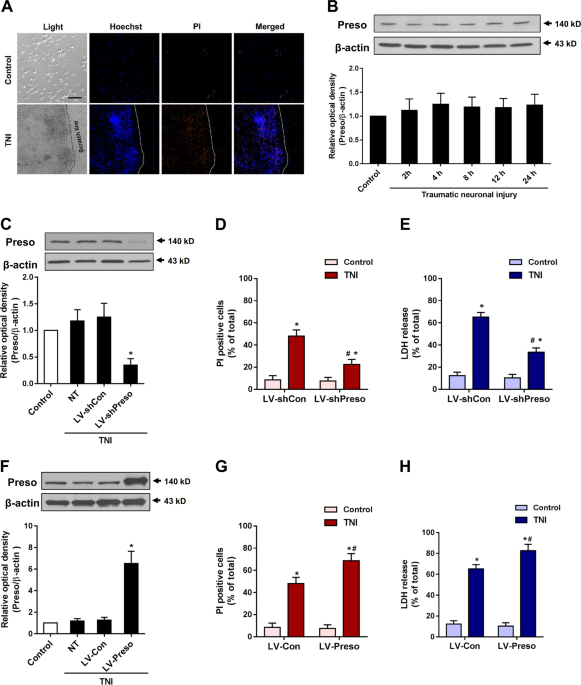 Preso regulates nmda receptor-mediated excitotoxicity via modulating nitric oxide and calcium responses after traumatic brain injury