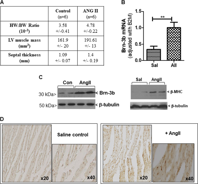 The Pou4f2 Brn 3b Transcription Factor Is Required For The Hypertrophic Response To Angiotensin Ii In The Heart Cell Death Disease