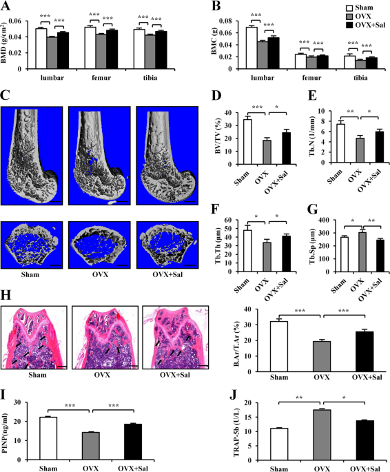 Eif2a Signaling Regulates Autophagy Of Osteoblasts And The Development Of Osteoclasts In Ovx Mice Cell Death Disease