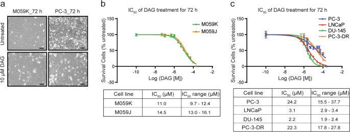 Dianhydrogalactitol synergizes with topoisomerase poisons to 