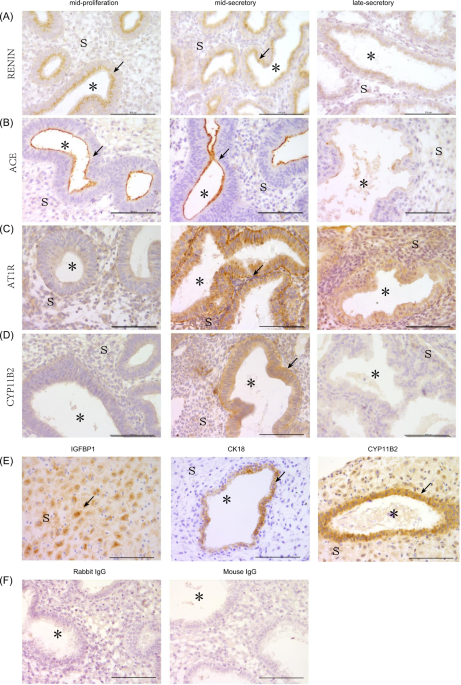 Aldosterone from endometrial glands is benefit for human decidualization