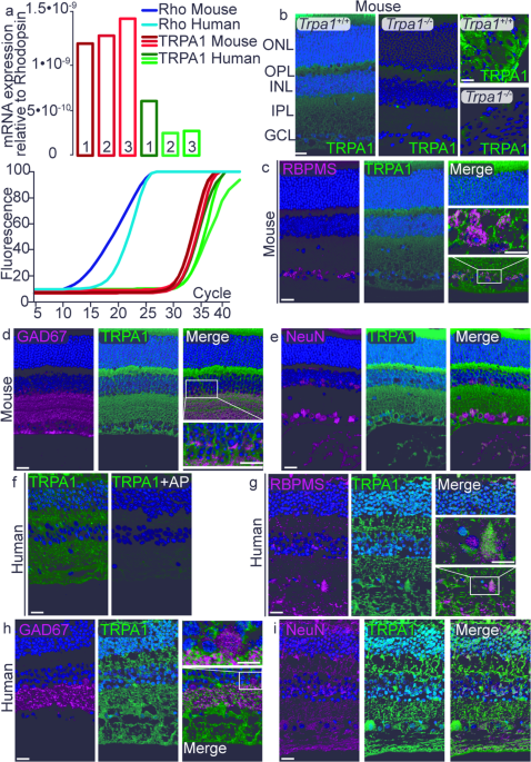 Trpa1 mediates damage of the retina induced by ischemia and reperfusion in mice