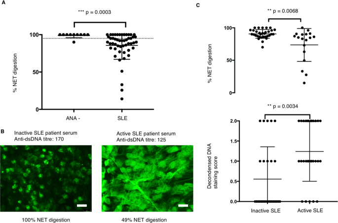 inflammation in sle