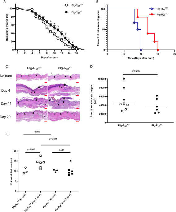 The Plasminogen Receptor Plg R Kt Plays A Role In Inflammation And Fibrinolysis During Cutaneous Wound Healing In Mice Cell Death Disease