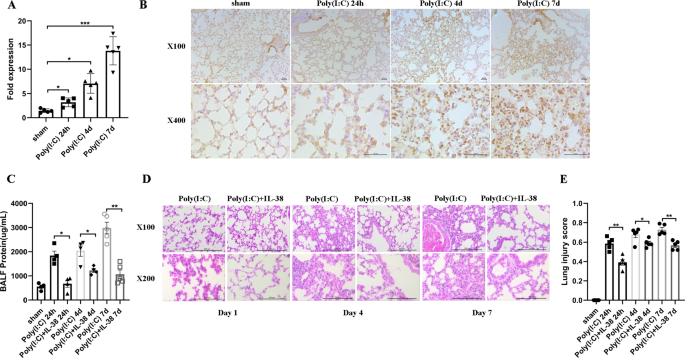 Interleukin-38 ameliorates poly(I:C) induced lung inflammation