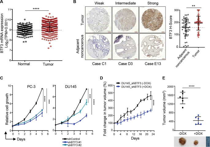 oncogenic activity in prostate cancer