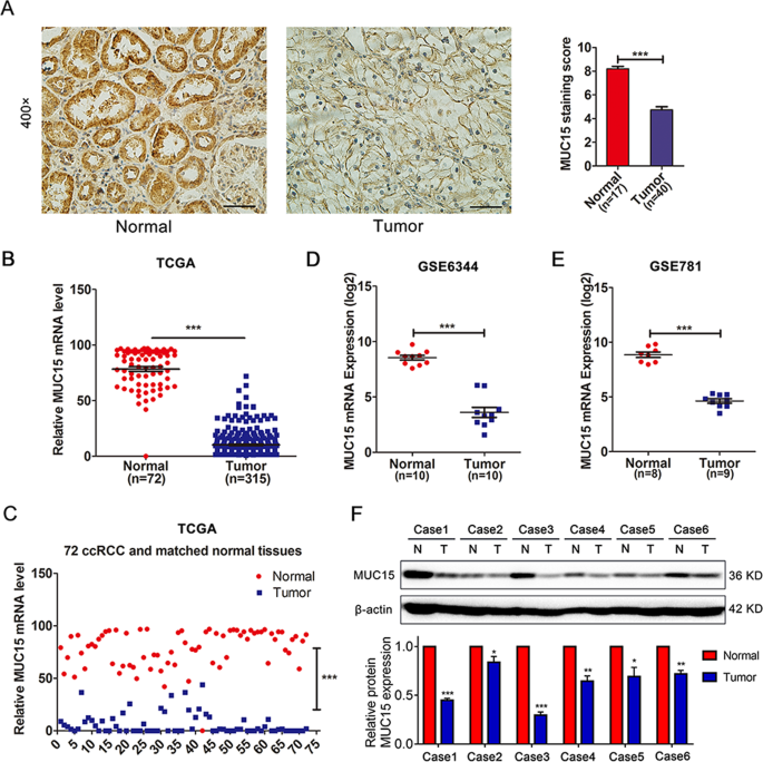 MUC15 inhibits cancer metastasis via PI3K/AKT signaling in renal cell  carcinoma | Cell Death & Disease