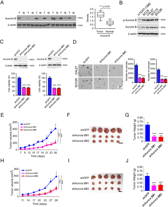 Targeting Aurora B Kinase With Tanshinone Iia Suppresses Tumor Growth And Overcomes Radioresistance Cell Death Disease