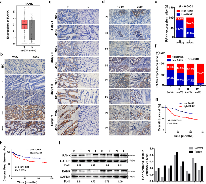 rank promotes colorectal cancer migration and invasion by activating the ca2 calcineurin nfatc1 acp5 axis cell death disease
