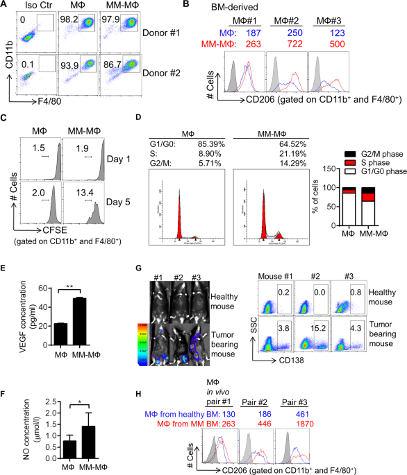 BMI1 regulates multiple myeloma-associated macrophage's pro-myeloma  functions