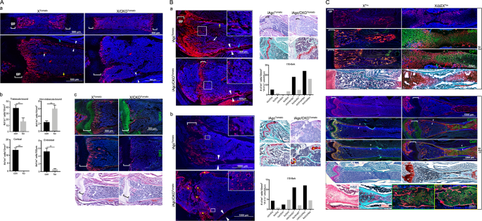 Wnt/ß-catenin-mediated p53 suppression is indispensable for osteogenesis of mesenchymal progenitor cells