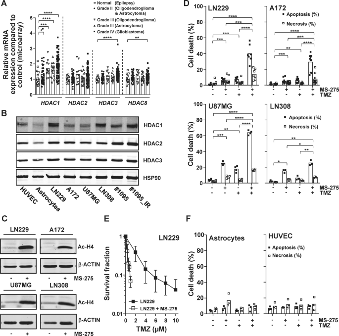 Class I Hdac Overexpression Promotes Temozolomide Resistance In Glioma Cells By Regulating Rad18 Expression Cell Death Disease