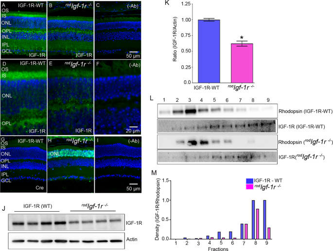 igf-1 lr3 receptor grade vs media grade (1mg) Insulin-like growth factor 1 receptor