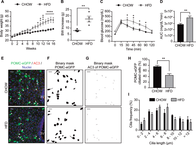 Palmitic Acid Control Of Ciliogenesis Modulates Insulin Signaling In Hypothalamic Neurons Through An Autophagy Dependent Mechanism Cell Death Disease Palmitic Acid Control Of Ciliogenesis Modulates Insulin Signaling In Hypothalamic Neurons Through An Autophagy Dependent Mechanism Cell Death Disease