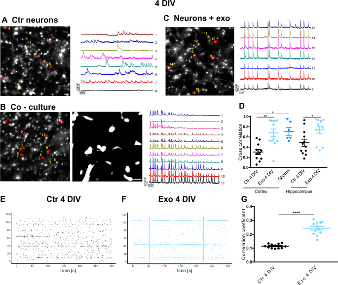 The dual action of glioma-derived exosomes on neuronal activity: synchronization and disruption of synchrony | Cell Death & Disease