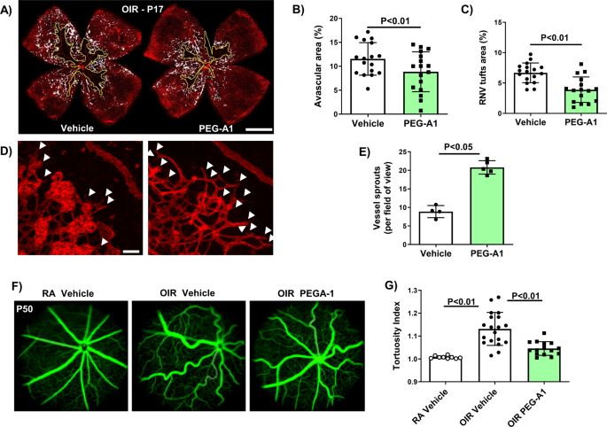 Targeting proliferative retinopathy: arginase 1 limits vitreoretinal neovascularization and promotes angiogenic repair