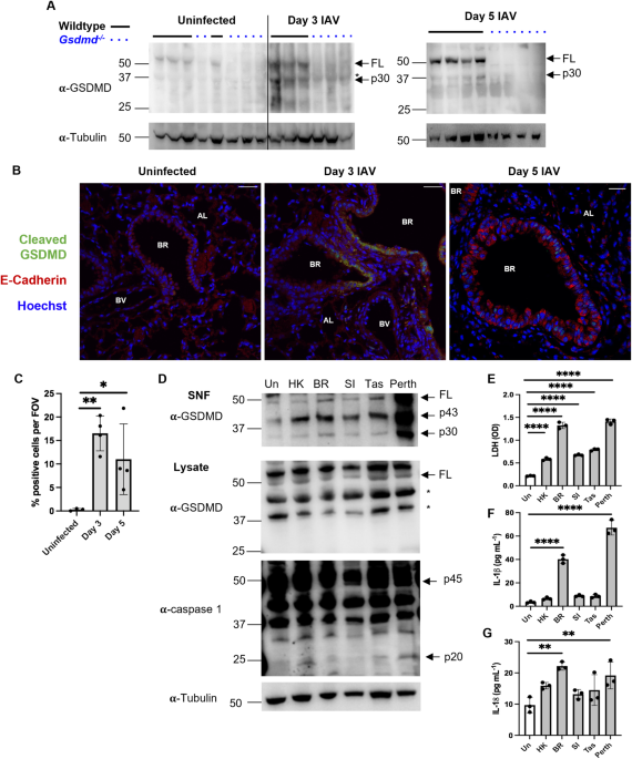 Gasdermin D promotes hyperinflammation and immunopathology during severe influenza A virus infection