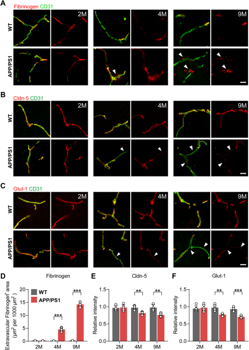 Endothelial DR6 in blood-brain barrier malfunction in Alzheimer’s ...