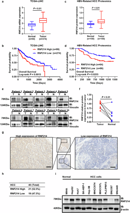Phase separation of RNF214 promotes the progression of hepatocellular carcinoma