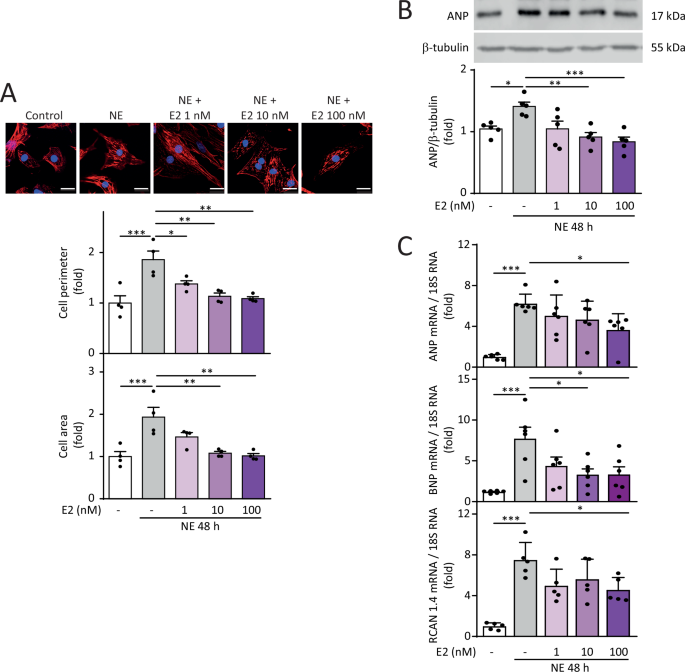 17-beta estradiol prevents cardiac myocyte hypertrophy by regulating mitochondrial e3 ubiquitin ligase 1