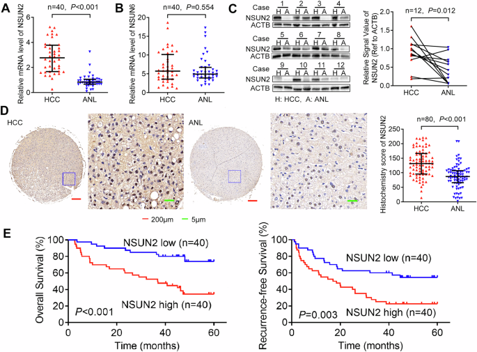The rna m5c methyltransferase nsun2 promotes progression of hepatocellular carcinoma by enhancing pkm2-mediated glycolysis
