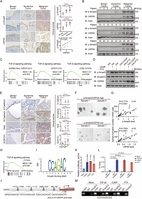USP9X integrates TGF- and hypoxia signalings to promote ovarian cancer  chemoresistance via HIF-2-maintained stemness | Cell Death & Disease