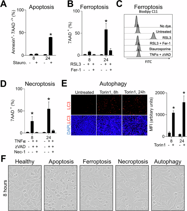 Deep transfer learning approach for automated cell death classification reveals novel ferroptosis-inducing agents in subsets of B-ALL
