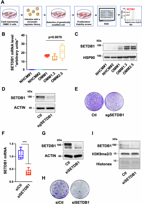 Setdb1 SETDB1 is critically required for uveal melanoma growth and represents ...
