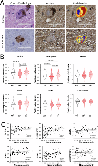 Ferroptosis inhibition protects against α-synuclein-related neuronal cell  death