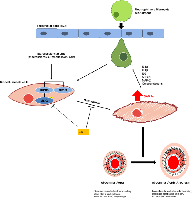 Loss of MLKL impairs abdominal aortic aneurysm development by attenuating  smooth muscle cell necroptosis