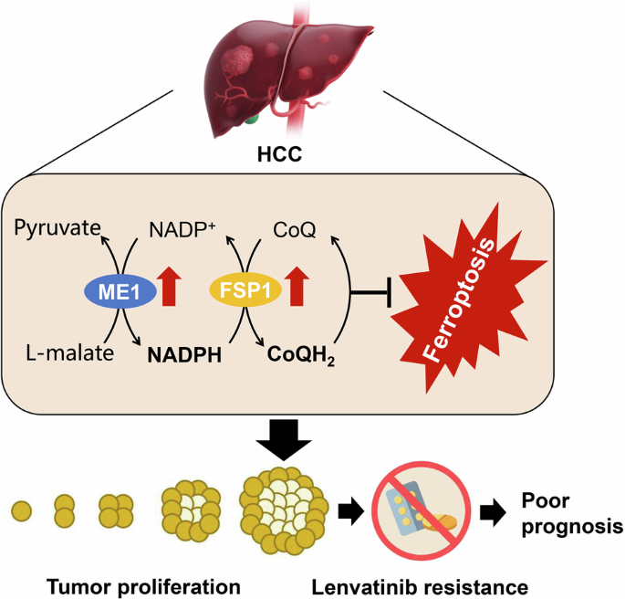 daily requirement of glutathione Malic enzyme 1 contributes to tumorigenesis and lenvatinib resistance in hepatocellular carcinoma via FSP1-dependent ferroptosis evasion