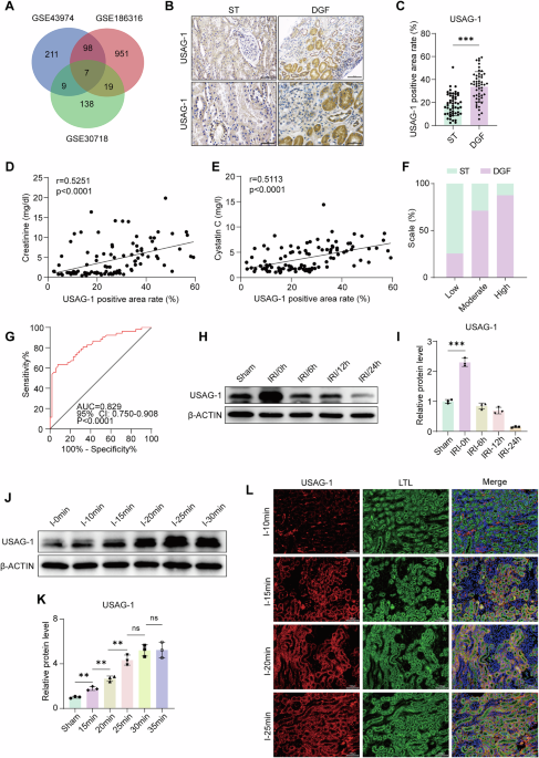 USAG-1 aggravates renal ischemia‒reperfusion injury via promoting GPX4 degradation-induced ferroptosis