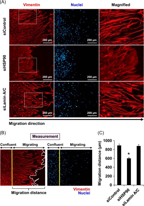 Molecular functional analyses revealed essential roles of HSP90 and lamin A/C in growth ...