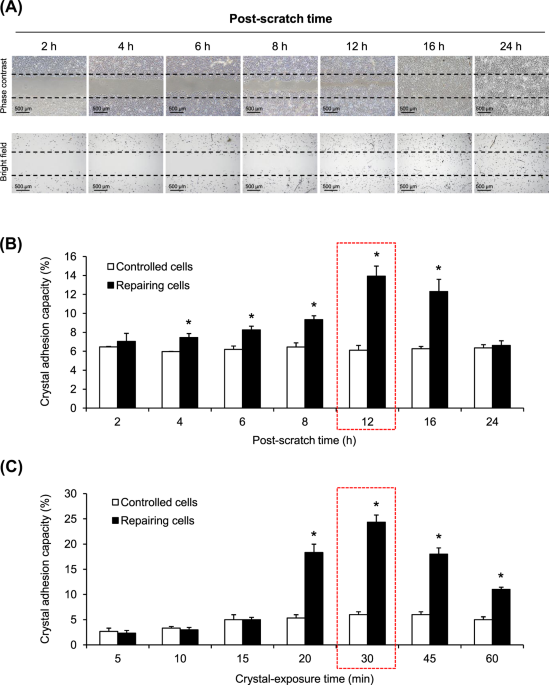Cell Cycle Shift From G0 G1 To S And G2 M Phases Is Responsible For Increased Adhesion Of Calcium Oxalate Crystals On Repairing Renal Tubular Cells At Injured Site Cell Death Discovery