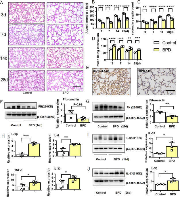 IL-33-induced neutrophil extracellular traps degrade fibronectin