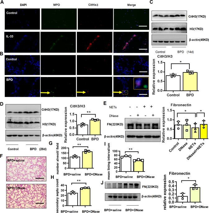 IL-33-induced neutrophil extracellular traps degrade fibronectin