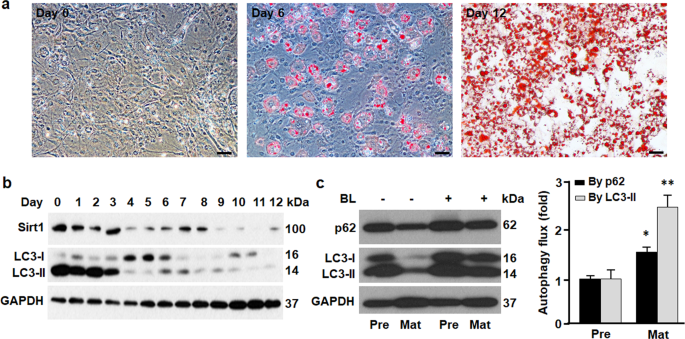 Sirt1 Coordinates With Era To Regulate Autophagy And Adiposity Cell Death Discovery