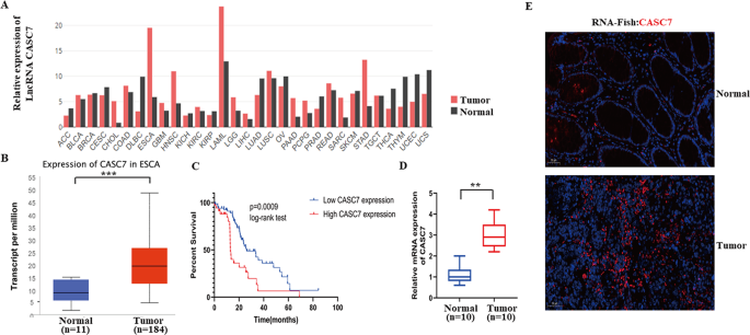 Long noncoding rna casc7 is a novel regulator of glycolysis in oesophageal cancer via a mir-143-3p-mediated hk2 signalling pathway