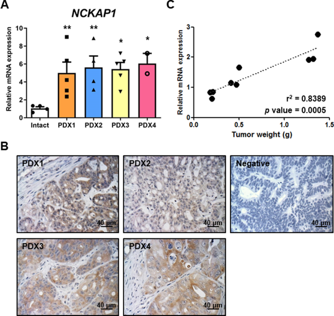 Nck-associated protein 1 regulates metastasis and is a novel prognostic marker for colorectal cancer