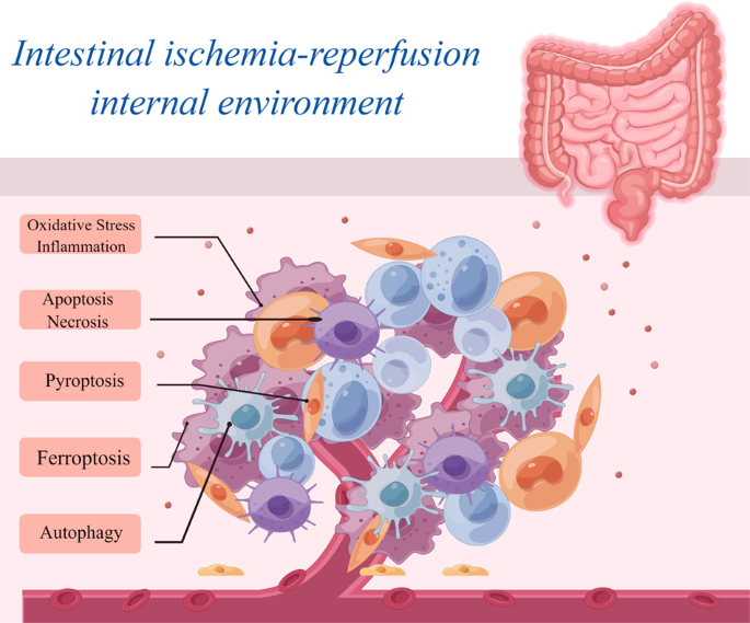 Targeting cell death pathways in intestinal ischemia-reperfusion injury: a comprehensive review