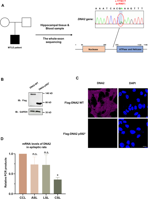 A novel mutation of DNA2 regulates neuronal cell membrane potential and epileptogenesis